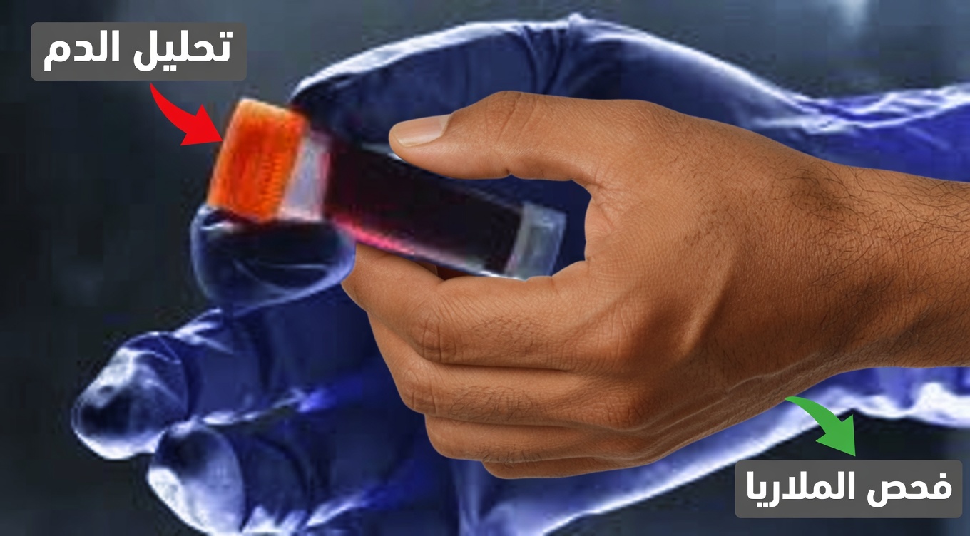 يكشف الأطباء: يبدو أن فصيلة الدم O مرتبطة بأقل خطر إجمالي للإصابة بالسرطان وفقًا لعدة دراسات