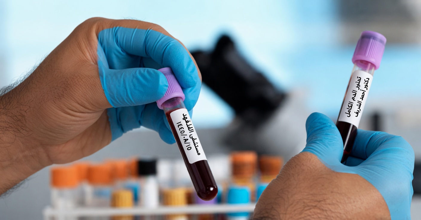 يكشف الأطباء: يبدو أن فصيلة الدم O مرتبطة بأقل خطر إجمالي للإصابة بالسرطان وفقًا لعدة دراسات