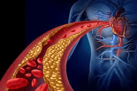 يكشف الأطباء: يبدو أن فصيلة الدم O مرتبطة بأقل خطر إجمالي للإصابة بالسرطان وفقًا لعدة دراسات