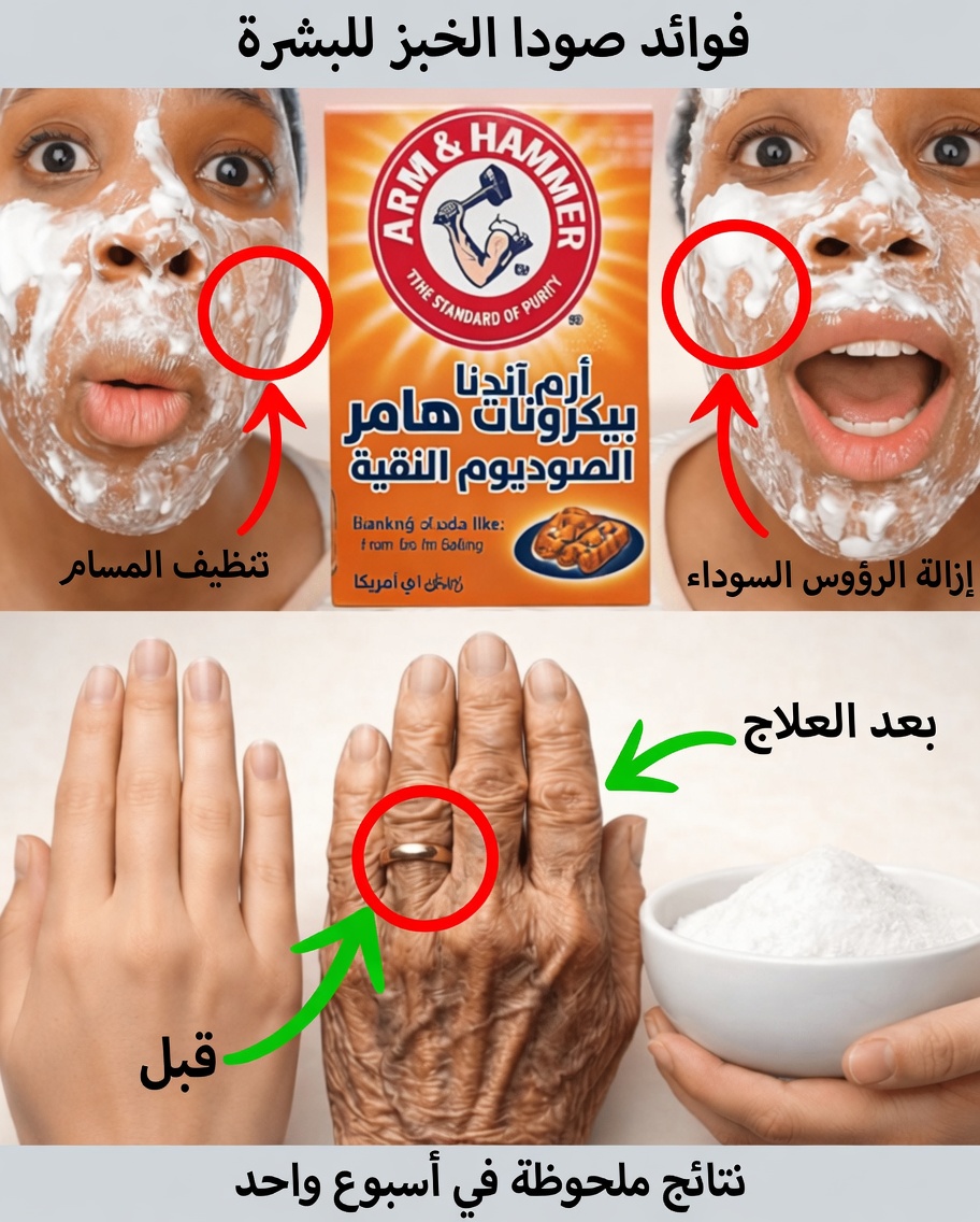 أقنعة الوجه بصودا الخبز: وصفات منزلية شائعة وما تحتاج إلى معرفته لصحة البشرة