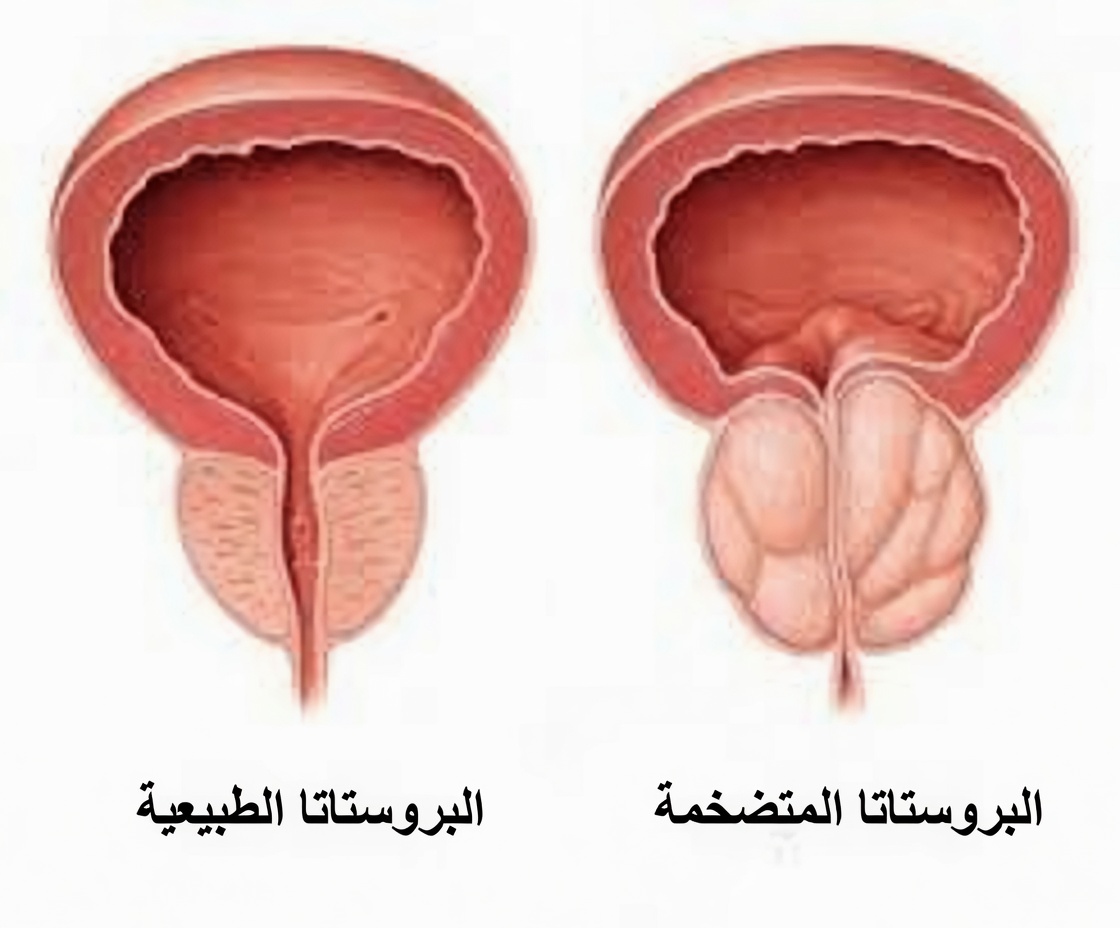 أعد اكتشاف الراحة: فاكهة يومية واحدة قد تدعم صحة البروستاتا