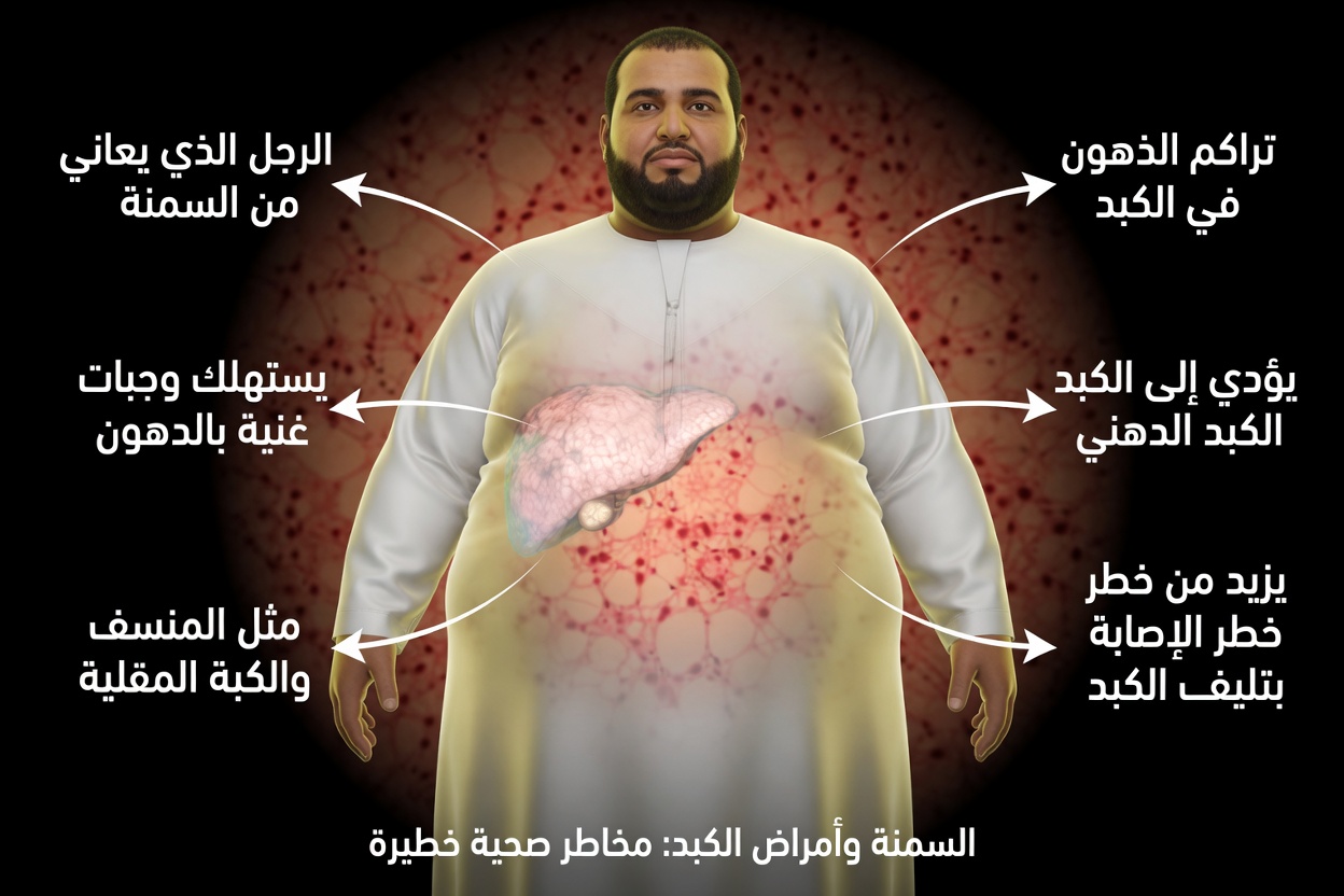 ما هي أكثر العلامات شيوعًا لمرض الكبد الدهني؟ التعرّف على التعب ومؤشرات مبكرة أخرى