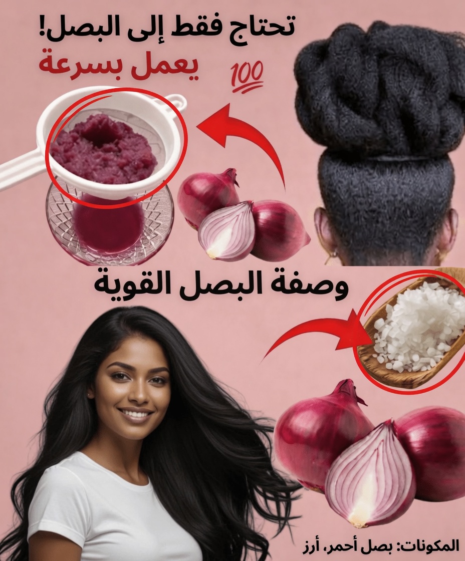 عصير البصل لنمو الشعر: ماذا يمكن أن يفعله 7 أيام فقط لفروة رأسك