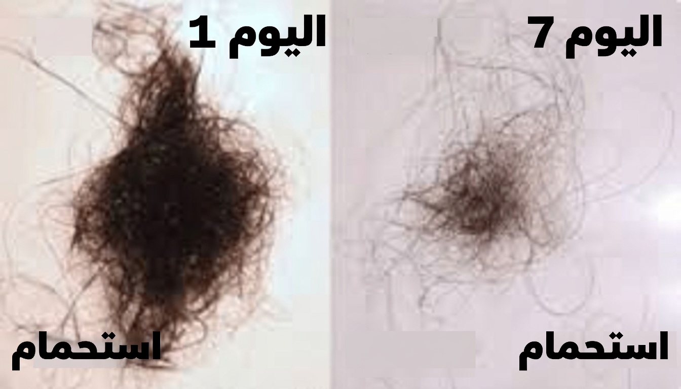 عصير البصل لنمو الشعر: ماذا يمكن أن يفعله 7 أيام فقط لفروة رأسك