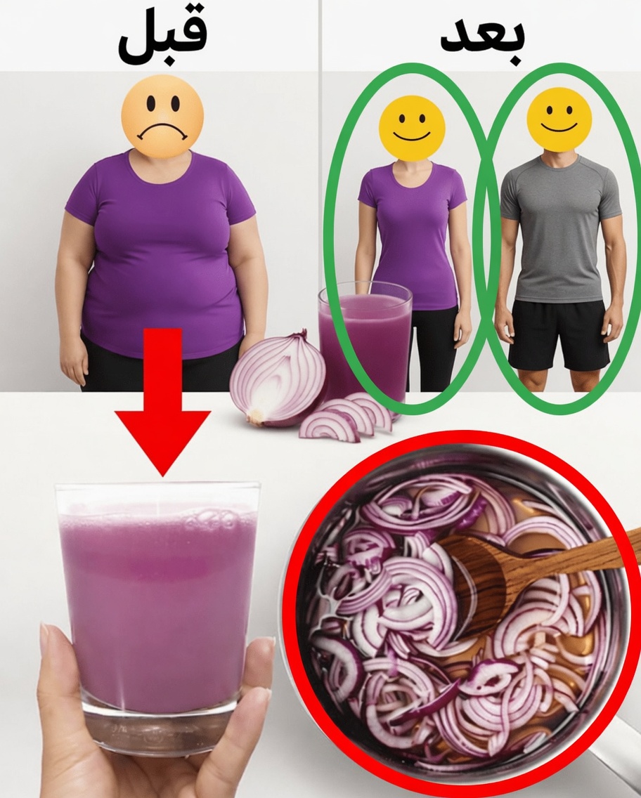 مشروب البصل الأرجواني المذهل الذي يساعد على حرق دهون البطن طبيعيًا