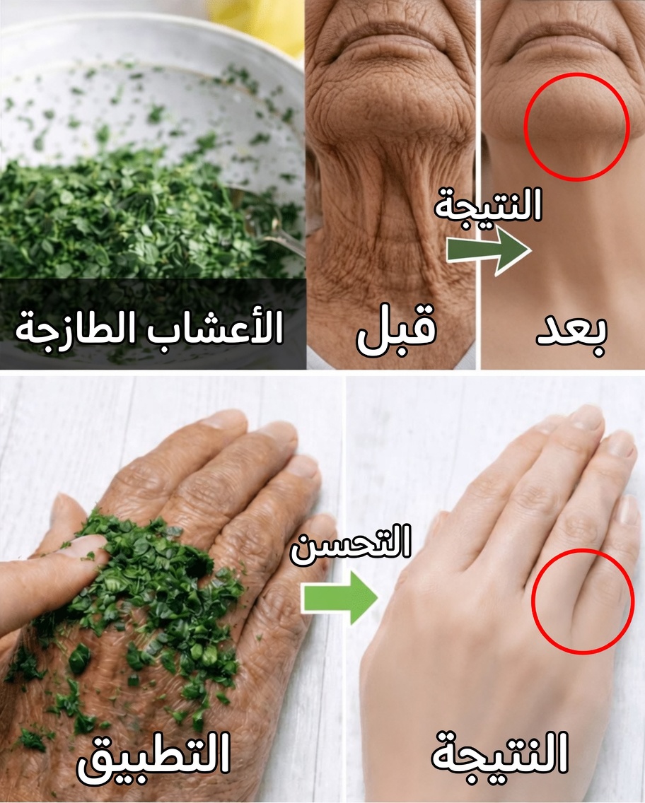 لقد صنعته بنفسي ولم يصدقني أحد، هذا القناع يساعدك على التخلص من التجاعيد والبقع