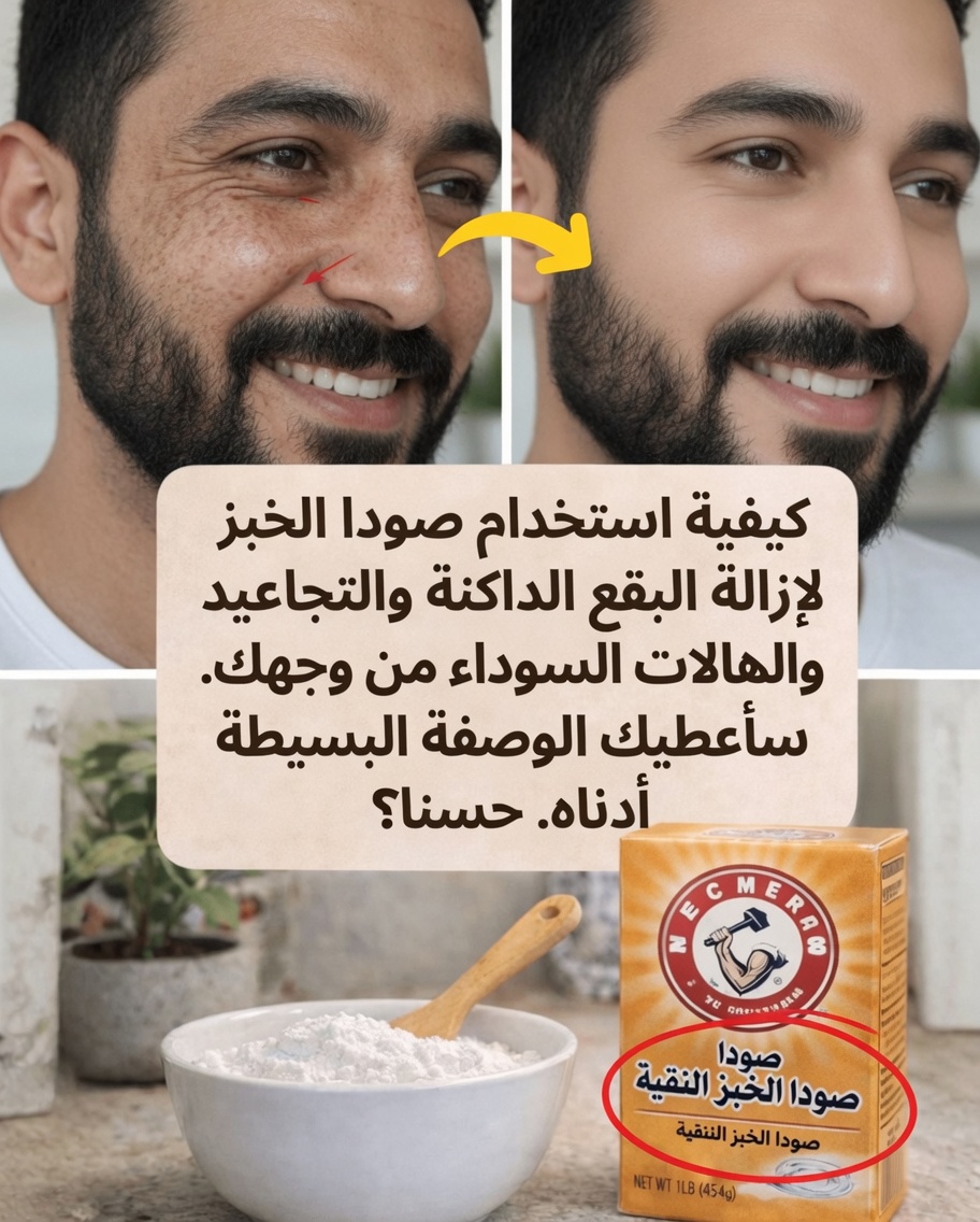 صودا الخبز على وجهك: استكشاف حيلة العناية بالبشرة المنزلية الرائجة مع كشف الفوائد والمخاطر المحتملة