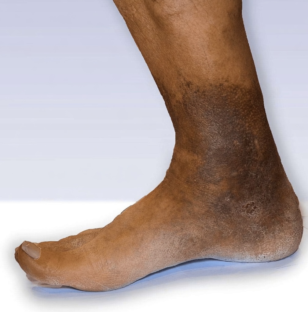 7 علامات تحذيرية لانسداد الشرايين في ساقيك وقدميك – لا تتجاهل هذه الإشارات الصامتة