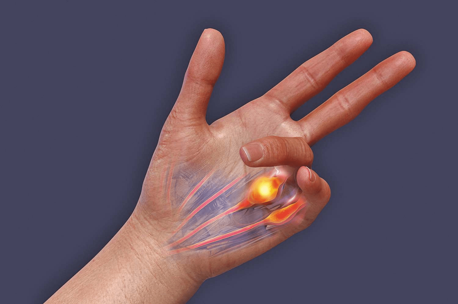 أول أعراض التصلب الجانبي الضموري لدى إريك داين: ما الذي يمكن أن يعلّمنا إياه ضعف يده المبكر عن التغيرات العصبية الدقيقة