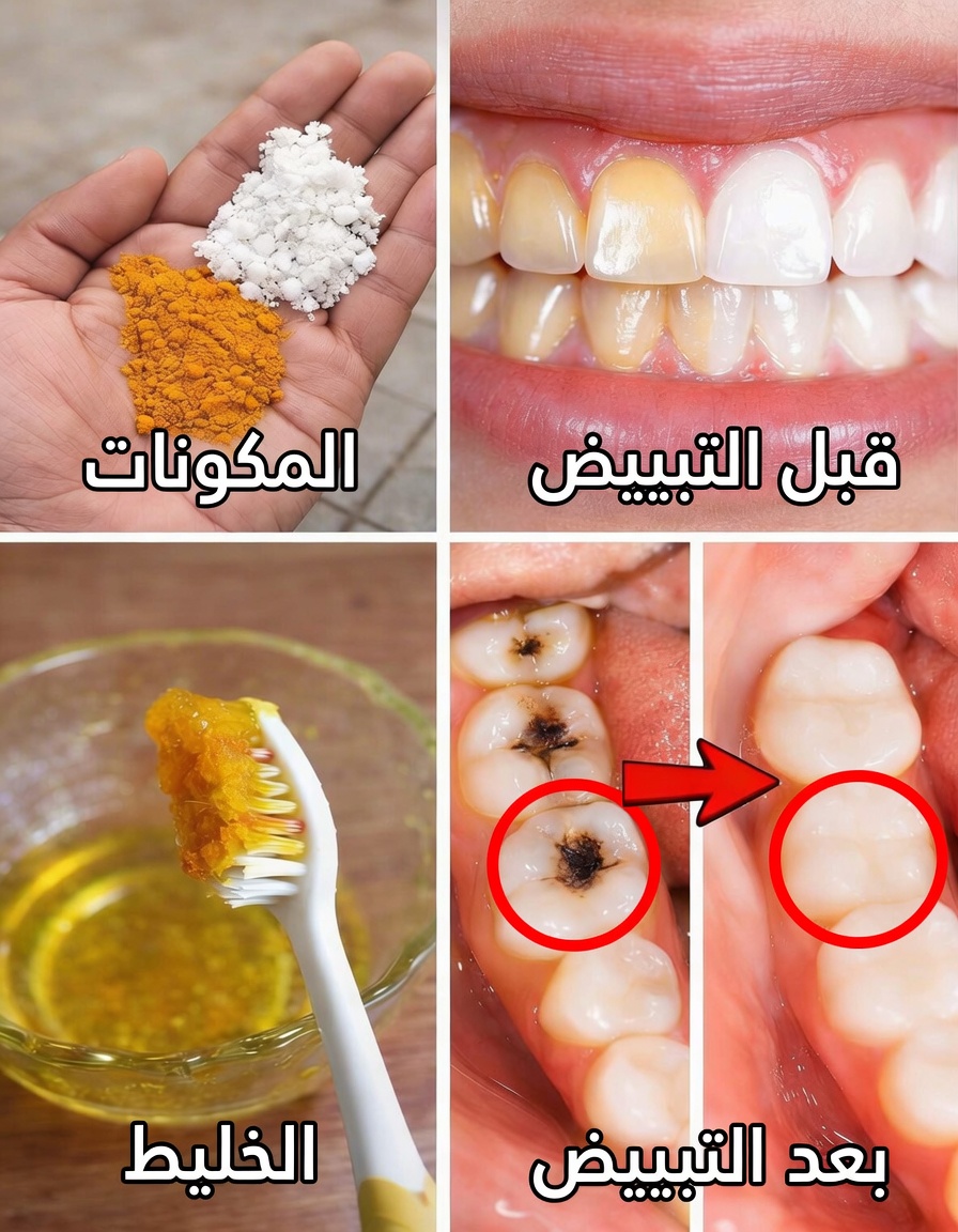 الكركم لتبييض الأسنان: هل هذا التابل الطبيعي يفتح ابتسامتك فعلاً؟