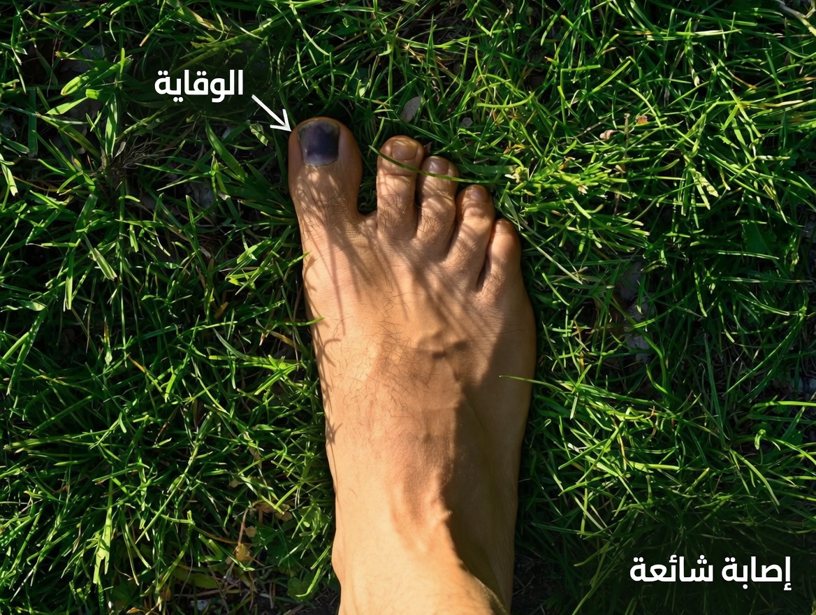 ما الذي قد يخبرك به ظفر قدمك الأسود: الأسباب الشائعة وعادات يومية ذكية تستحق النظر