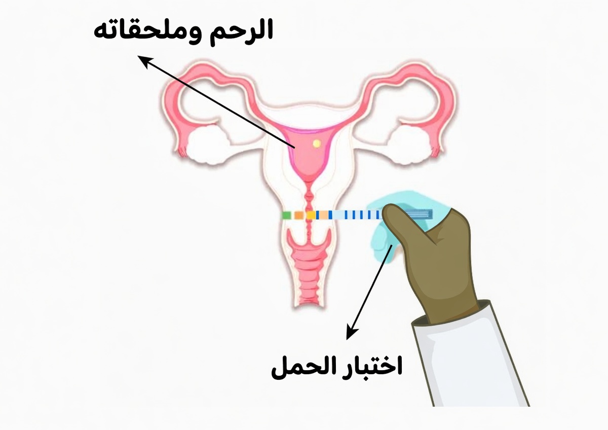 ملاحظة رائحة مهبلية حامضة؟ اكتشفي 4 أسباب شائعة وعادات يومية بسيطة لدعم التوازن