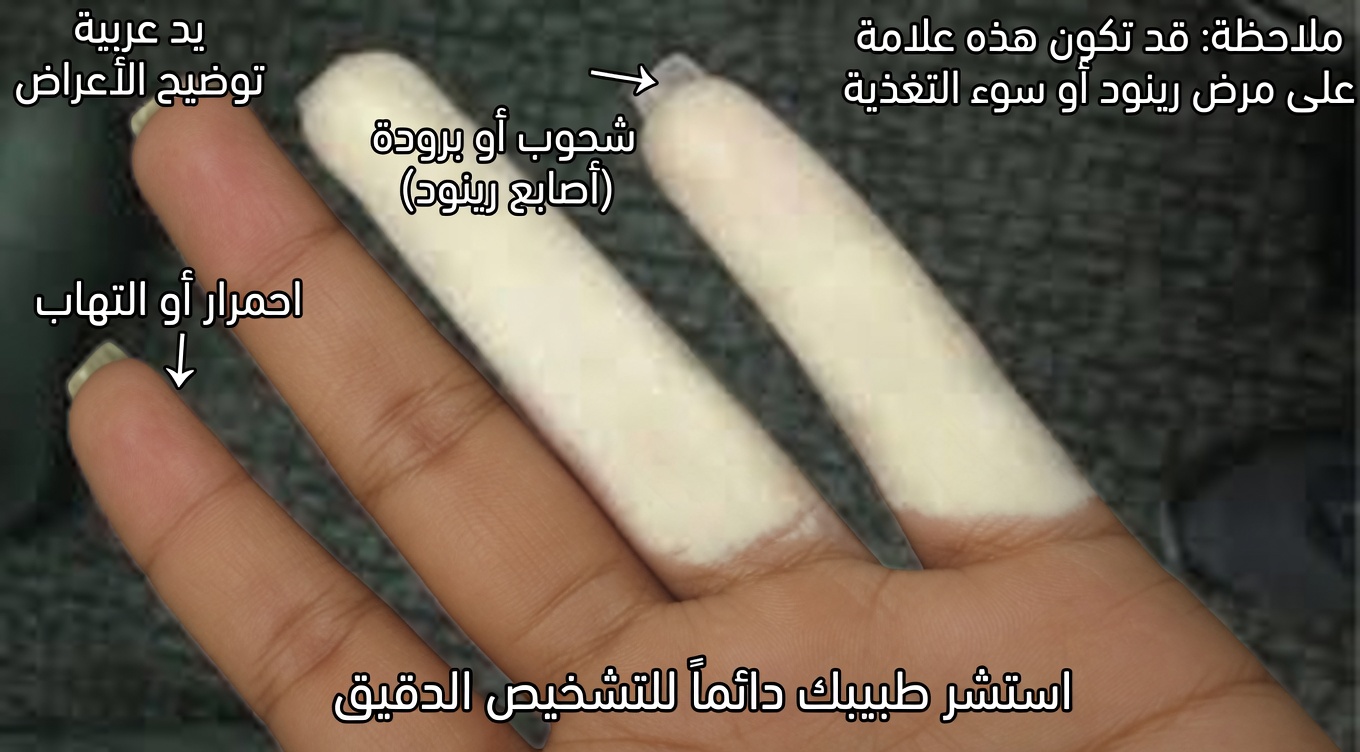 7 علامات تحذيرية مُهمَلة للسكتة الدماغية اللاكونية لدى الأشخاص فوق سن 60 (قد تكون تُفوّت العلامة رقم 4)