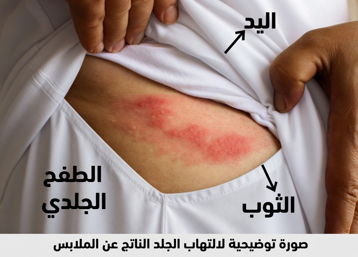 10 آثار جانبية للميتفورمين قد لا يذكرها طبيبك – ما تحتاج حقًا إلى معرفته