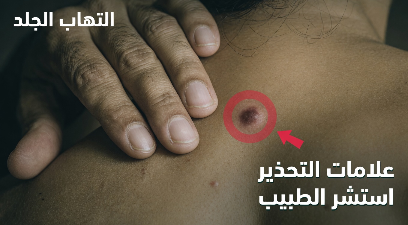 فهم الفرق بين الأكياس والأورام: دليل شامل للتعرّف على كتل الجلد وإدارتها بأمان