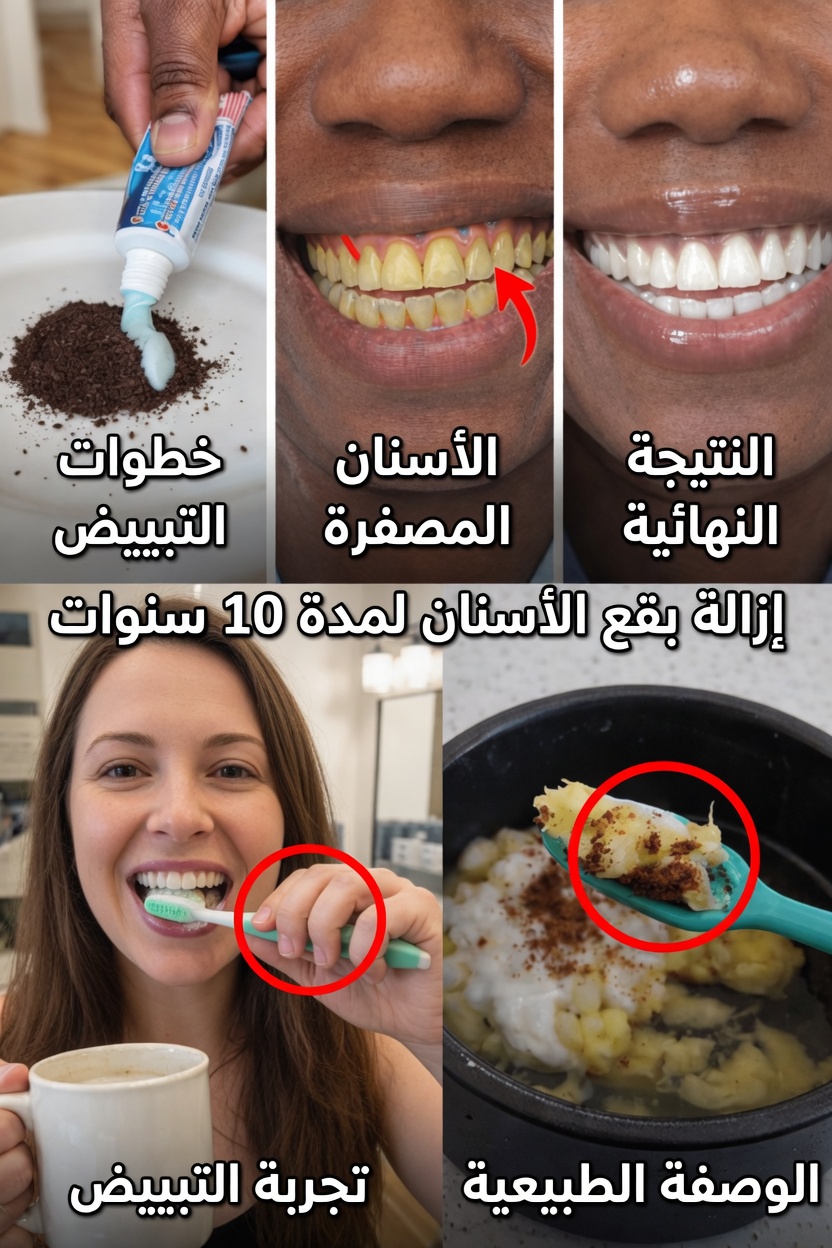 لماذا يحدث تغيّر لون الأسنان ولماذا يزعج الكثيرين