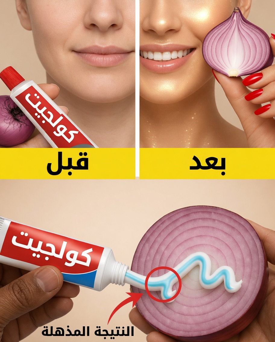 استكشاف حيلة طبيعية شائعة لإزالة الشعر: البصل ومعجون الأسنان