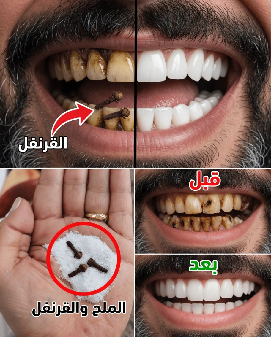 9 طرق طبيعية للمساعدة في تقليل تراكم البلاك والجير – استراتيجيات منزلية لطيفة لابتسامة أكثر إشراقًا
