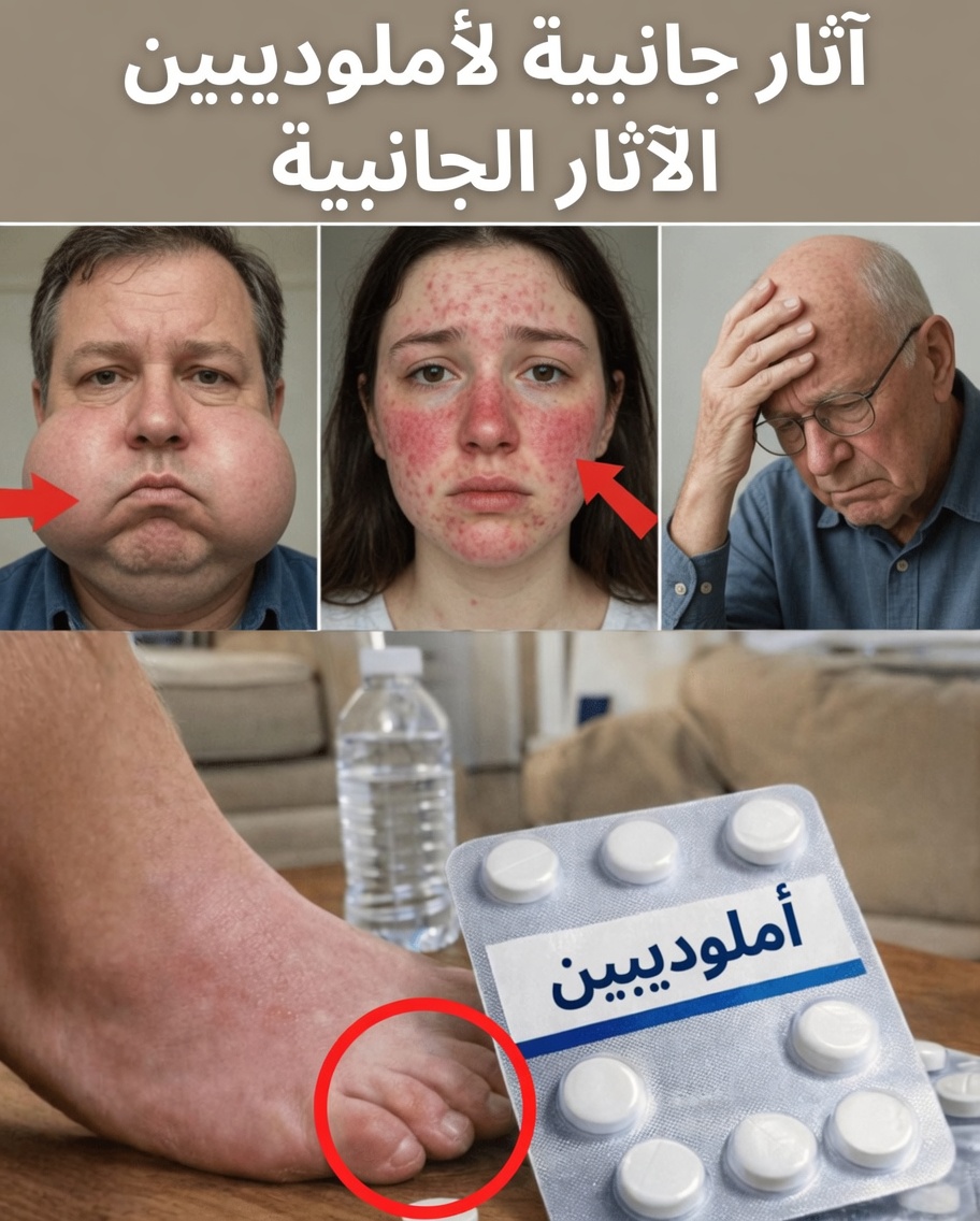 12 آثار جانبية شائعة وملحوظة لأملوديبين: ما الذي تحتاج إلى معرفته