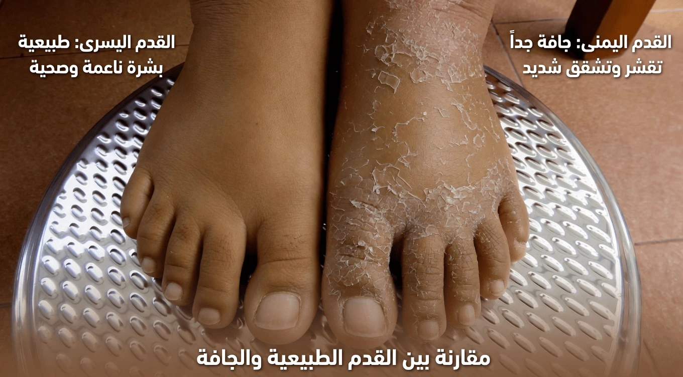 12 آثار جانبية شائعة وملحوظة لأملوديبين: ما الذي تحتاج إلى معرفته