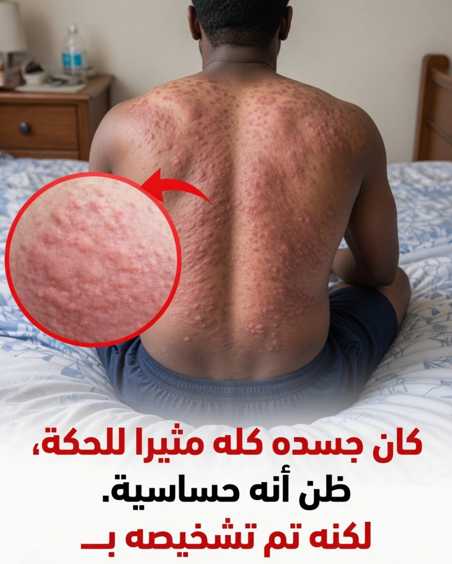 الحكة المستمرة التي تتجاوز الحساسية: متى قد تشير إلى شيء أكثر خطورة