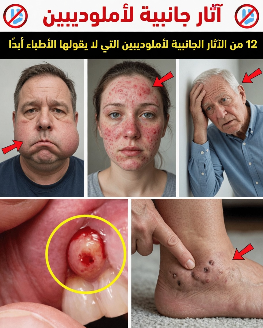 12 من الآثار الجانبية الأقل شيوعًا لأملوديبين التي ينبغي أن تكون على دراية بها