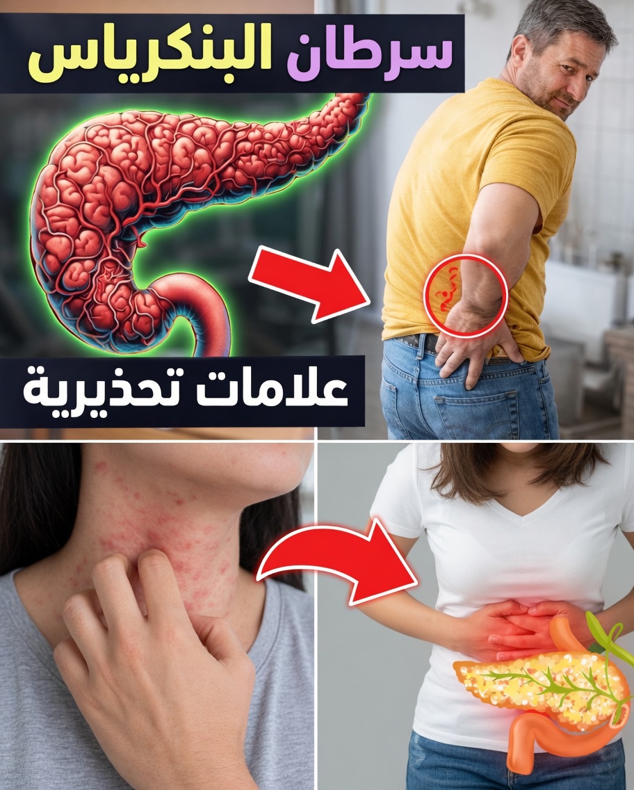 10 علامات تحذيرية خفية لسرطان البنكرياس لا ينبغي تجاهلها