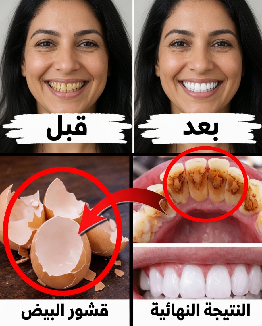 هل يمكن لقشور البيض أن تساعد في دعم أسنان أكثر بياضًا ومظهرًا أكثر صحة؟ نهج طبيعي جدير بالاستكشاف