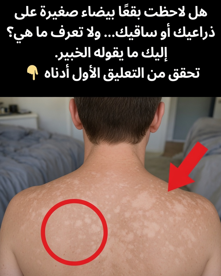 لماذا تظهر بقع بيضاء على بشرتك؟ الأسباب الشائعة وما يجب معرفته